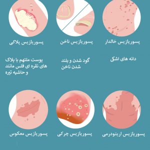 بیماری های پوستی