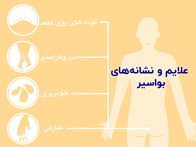 بواسير
