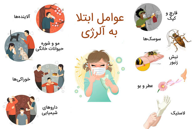 آلرژی