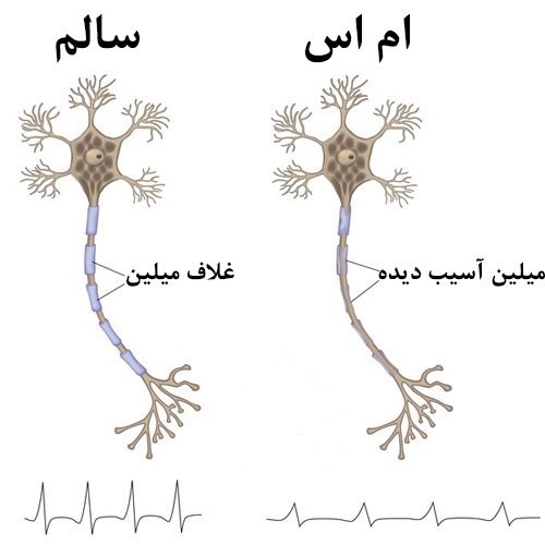 اِم اِس