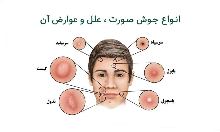 جوش های پوستی