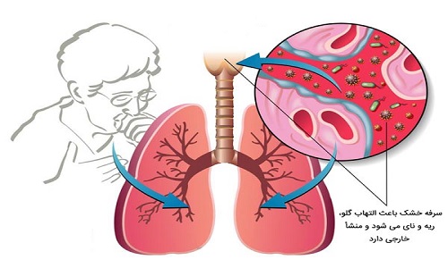 سرفه2