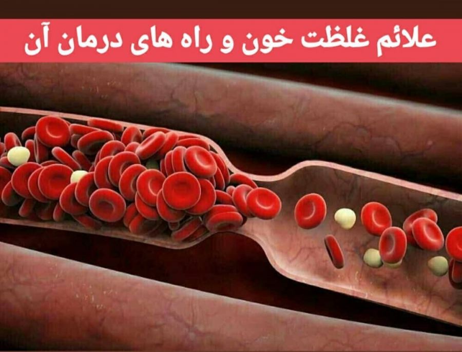 غلظت خون